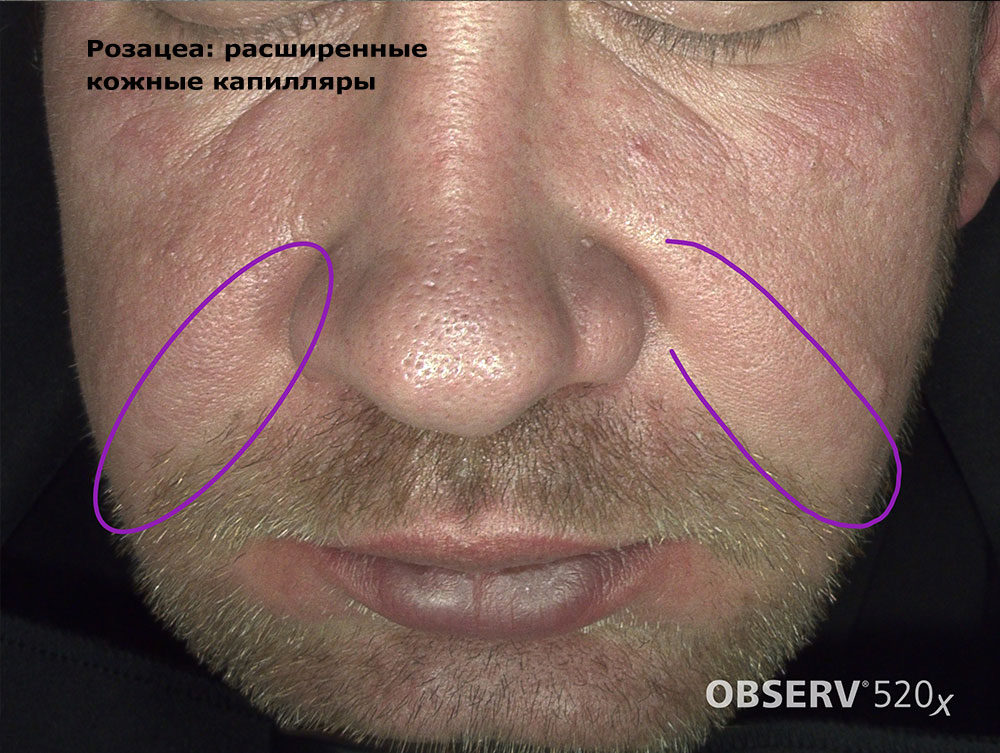 диагностика кожи